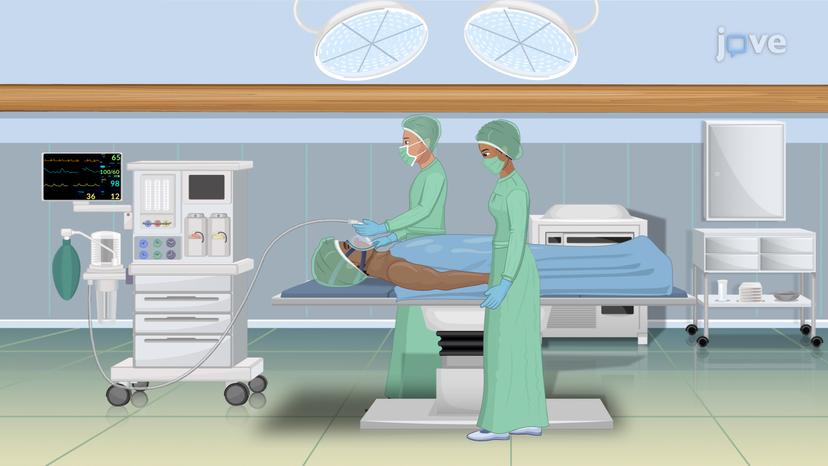 Stages of General Anesthesia