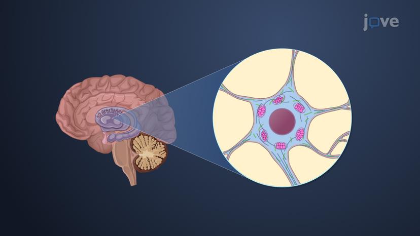 Parkinson's Disease: Overview