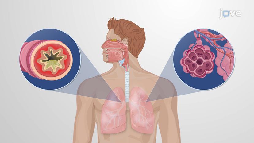 Drugs Used in Lower Respiratory Disorders: Overview