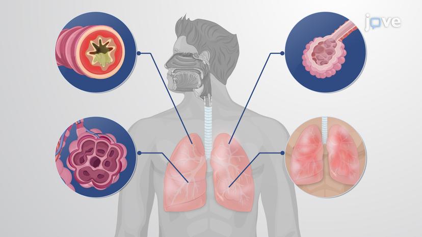 COPD: Pathogenesis and Clinical Features