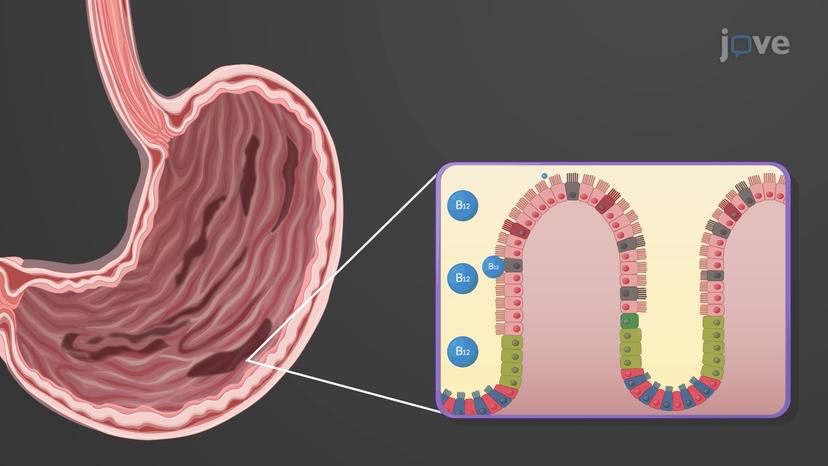 Disorders of Erythrocytes