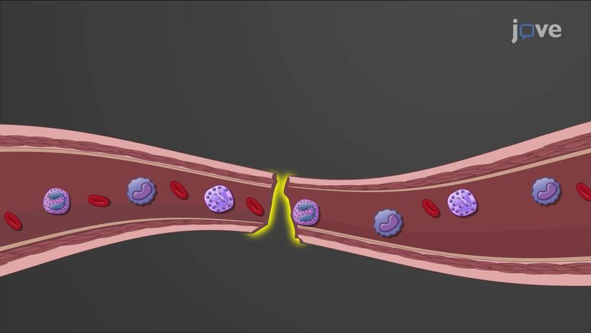 Vascular Spasm