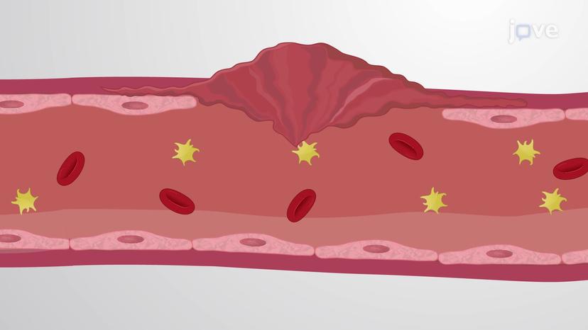 Coagulation