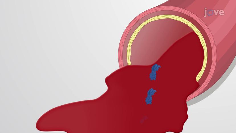 Extrinsic and Intrinsic Pathways of Hemostasis