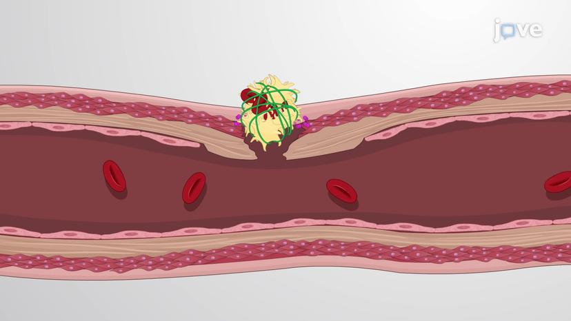 Clot Retraction and Fibrinolysis