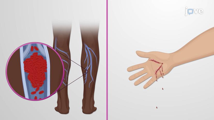 Disorders of Hemostasis