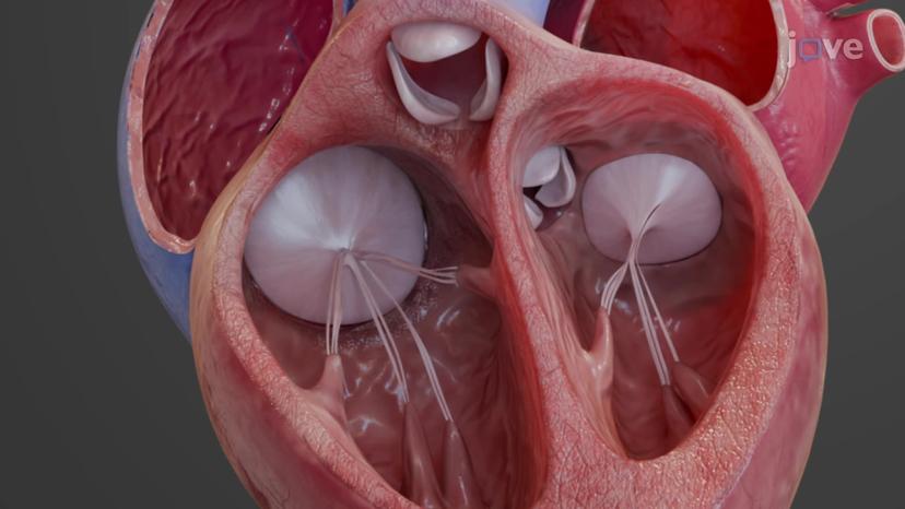 Heart Valves