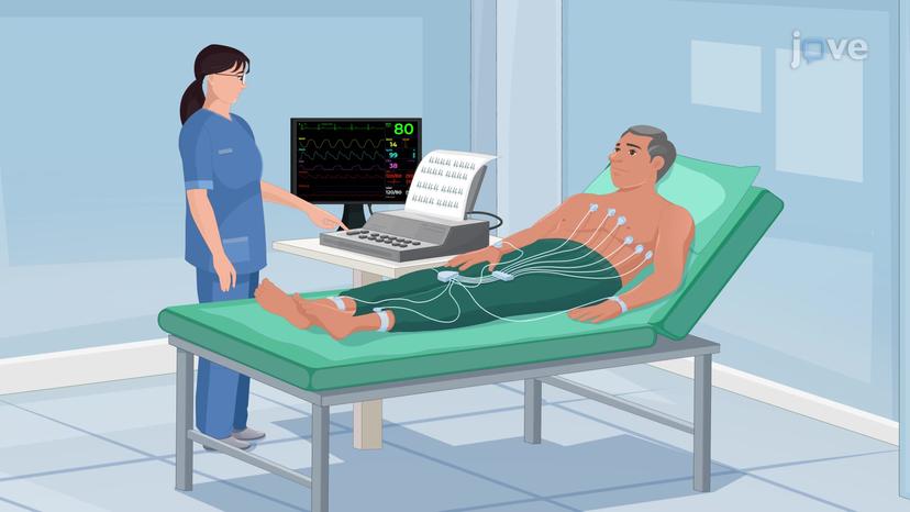 Electrocardiogram