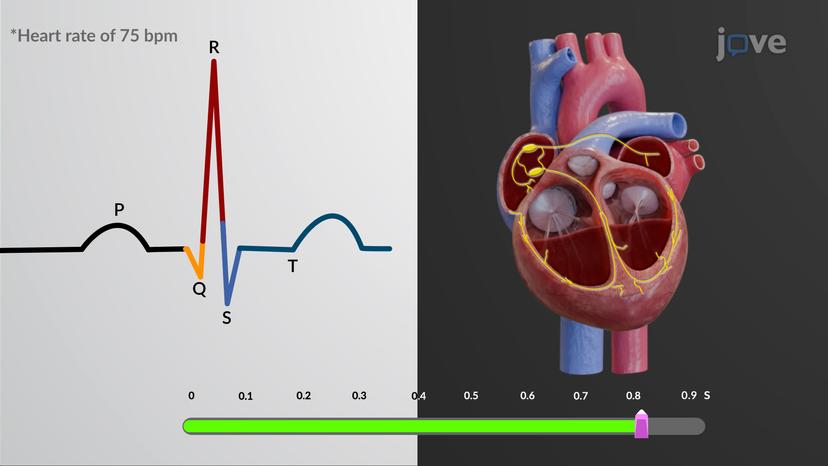 Correlation between ECG and Cardiac Cycle