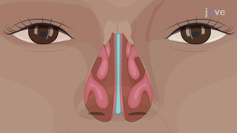 Nose and Nasal Cavity