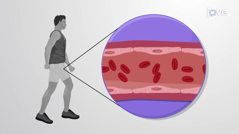 Exercise and Cardiovascular Response