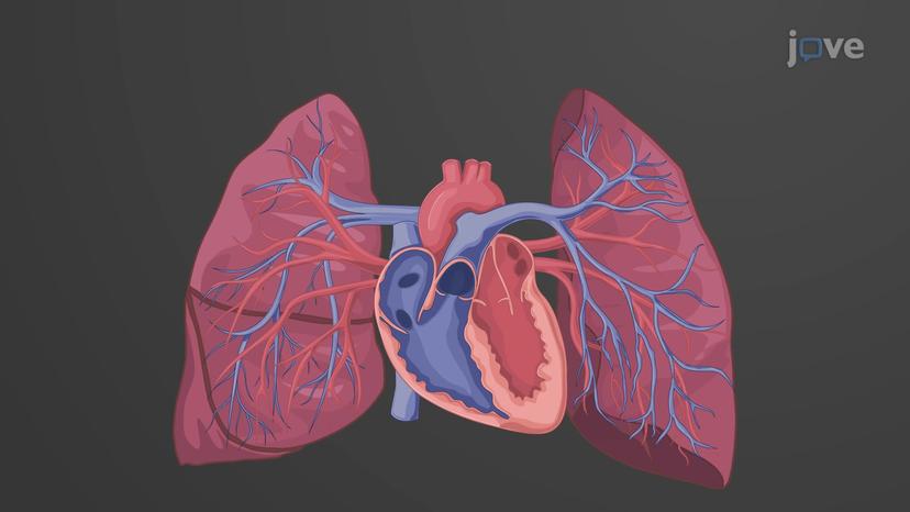 Overview of Systemic Arteries