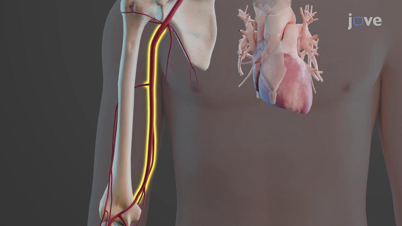 Arteries of the Upper Limbs