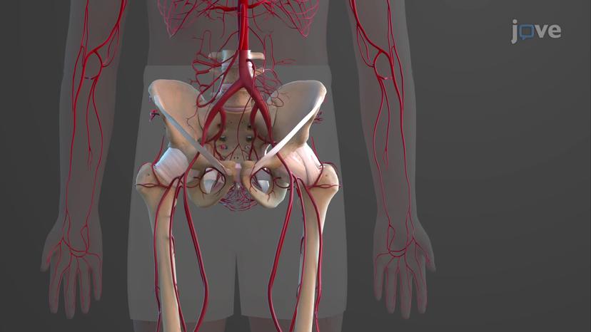 Arteries of Lower Limbs