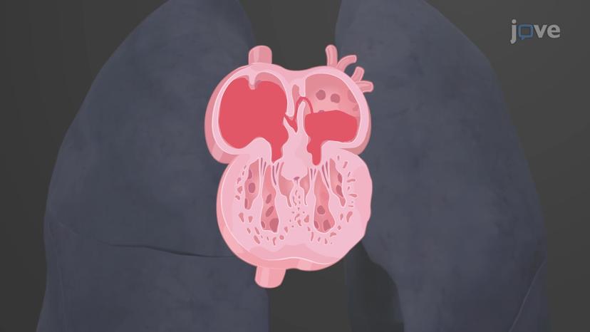 Fetal Circulation