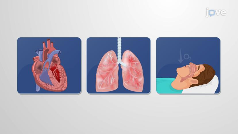 Pulmonary Hypertension: Classification and Pathogenesis