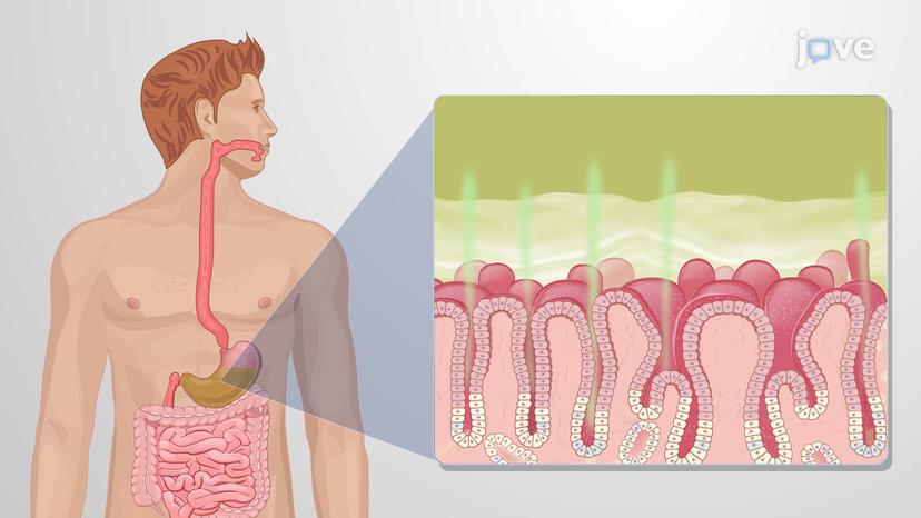 Treating Helicobacter pylori in Peptic Ulcers: Antimicrobial Therapy