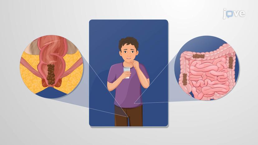 Drugs Affecting GI Tract Motility: Opioids as Antidiarrheal Agents