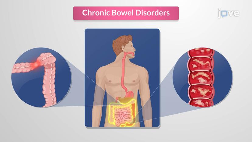 Chronic Bowel Disorders: Introduction