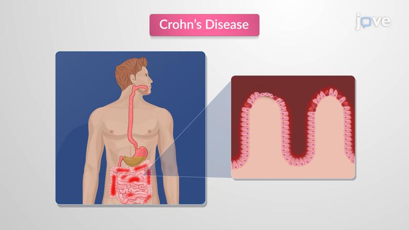 Drugs for Treatment of Crohn's Disease in IBD Using Immunomodulatory Agents