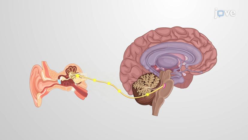 Pathophysiology of Vomiting