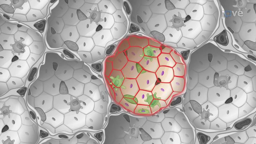 Alveoli and Alveolar Ducts