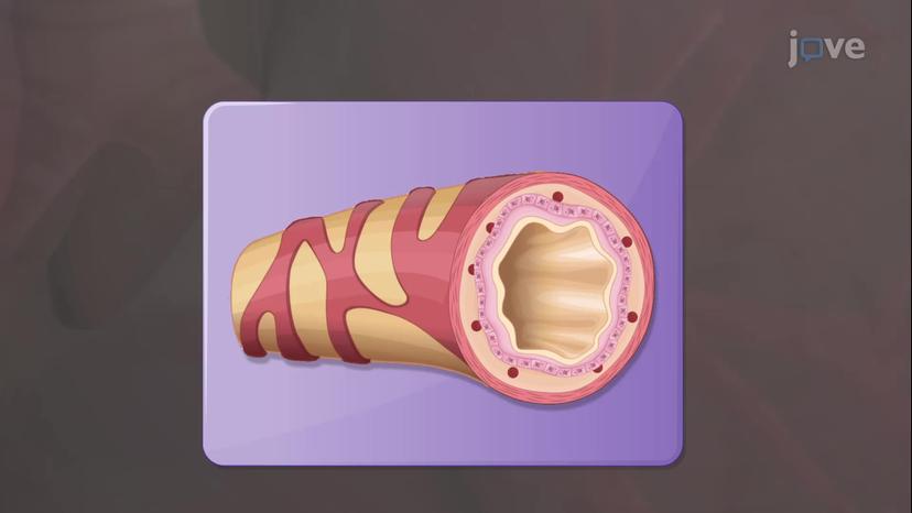 Other Pulmonary Disorders