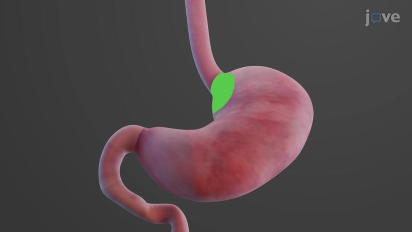 Gross Anatomy of the Stomach