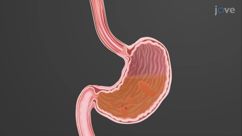 Gastric Emptying