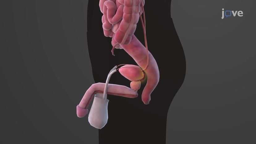 Urinary Bladder