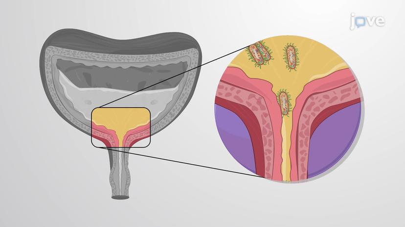 Disorders of the Urinary System