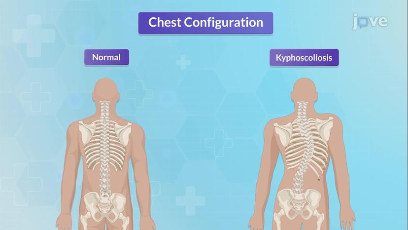 Physical Assessment of the Respiratory Tract II: Inspection