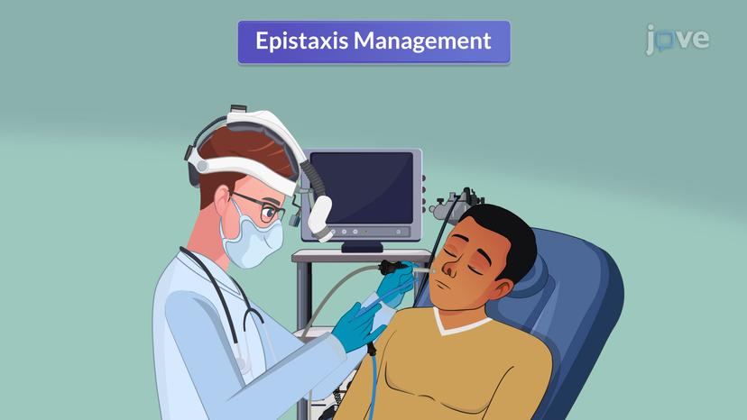 Epistaxis