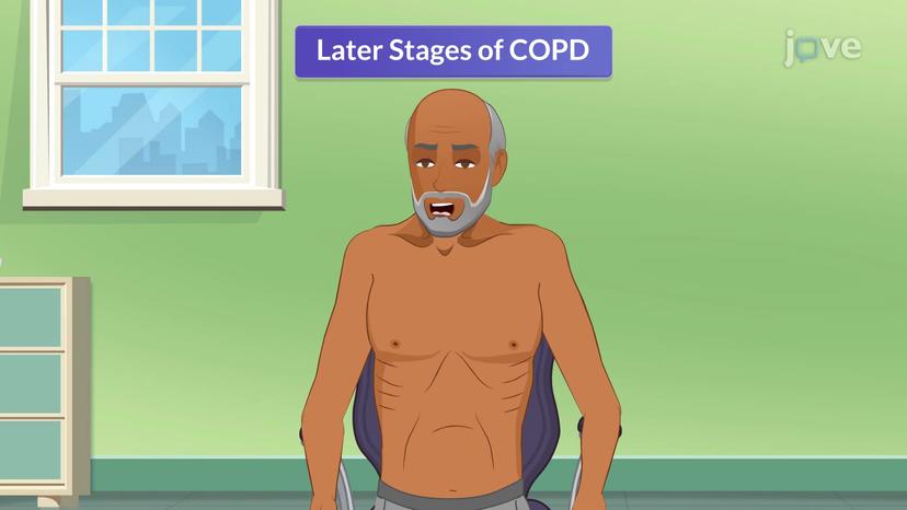 Chronic Obstructive Pulmonary Disease-III: Symptoms and Complications.