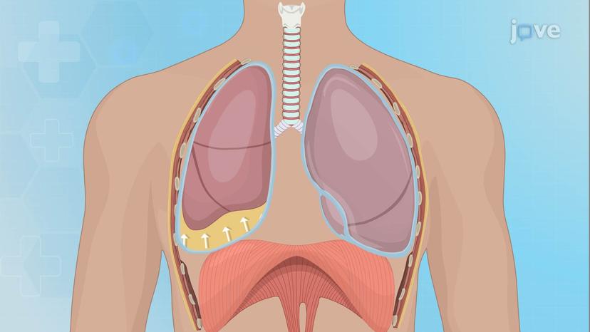 Pleural Effusion I: Introduction