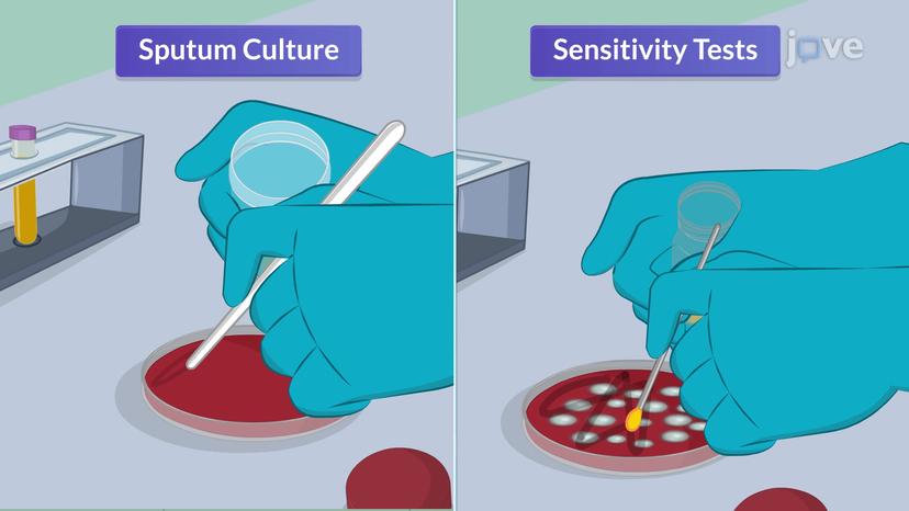 Sputum Studies II: Culture and Sensitivity