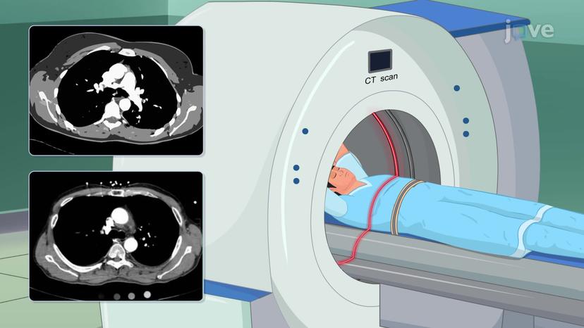 Radiological Investigation I: X-ray and CT