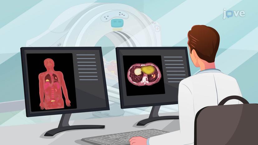 Radiological Investigation III: Pulmonary Angiogram and PET Scan