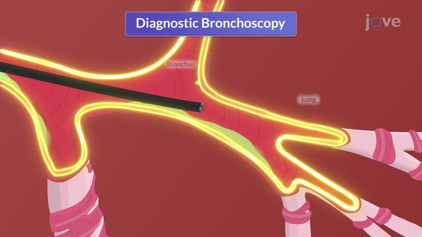 Endoscopic Studies I: Bronchoscopy and Thoracoscopy