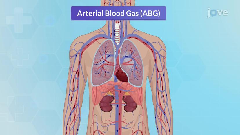 Blood Studies I: ABG and VBG