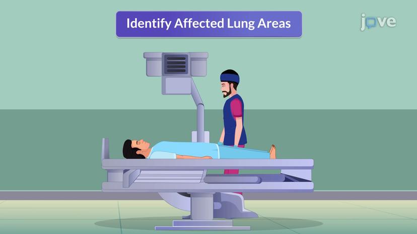 Chest Physiotherapy