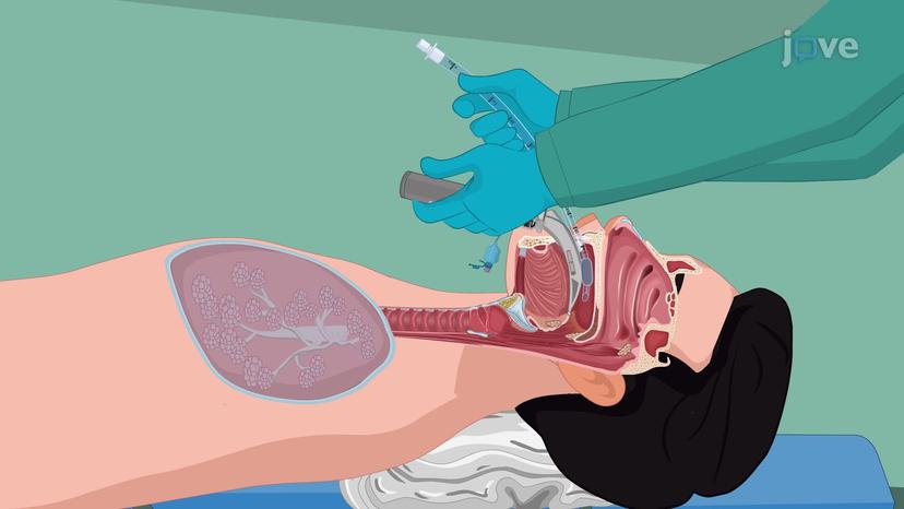 Endotracheal Intubation I: Procedure