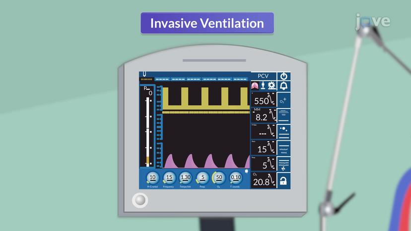 Mechanical Ventilation II: Invasive Ventilation