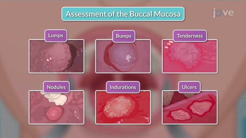 Assessment of the Mouth