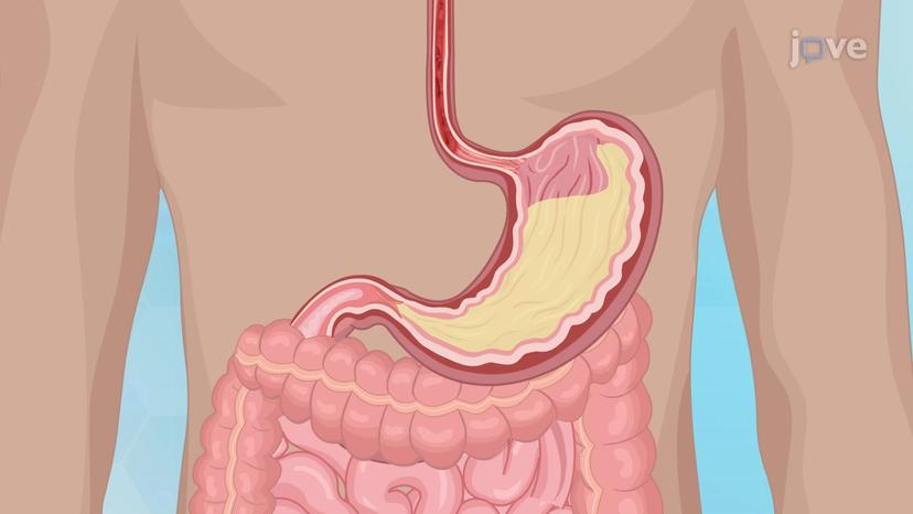 Gastroesophageal Reflux Disease I: Meaning and Pathophysiology