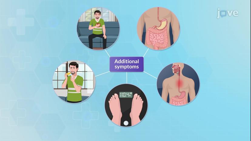 Esophageal Strictures-II: Clinical Features and Management