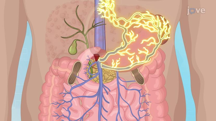 Esophageal Varices-I: Introduction