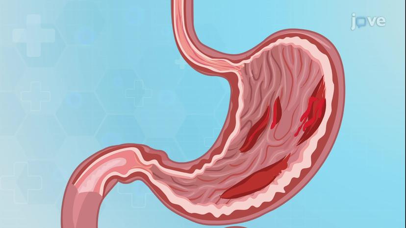 Gastritis III: Clinical Manifestations and Management