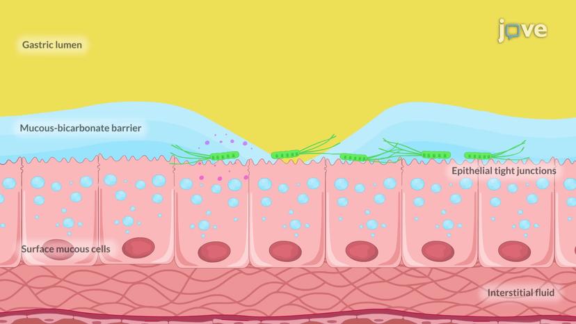 Peptic Ulcer Disease I: Introduction