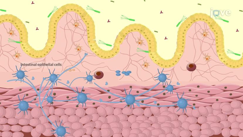 Irritable Bowel Syndrome I: Introduction